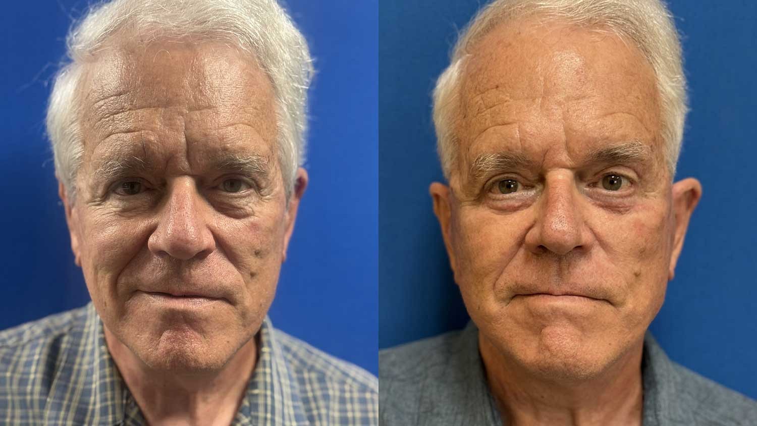 Weekend Facelift Before & After